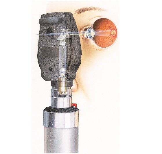 Conoce el oftalmoscopio, qué es y para qué es utilizado